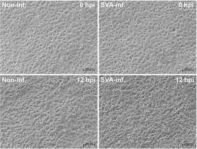 Senecavirus A- and Non-Infected Cells at Early Stage of Infection: Comparative Metabolomic Profiles